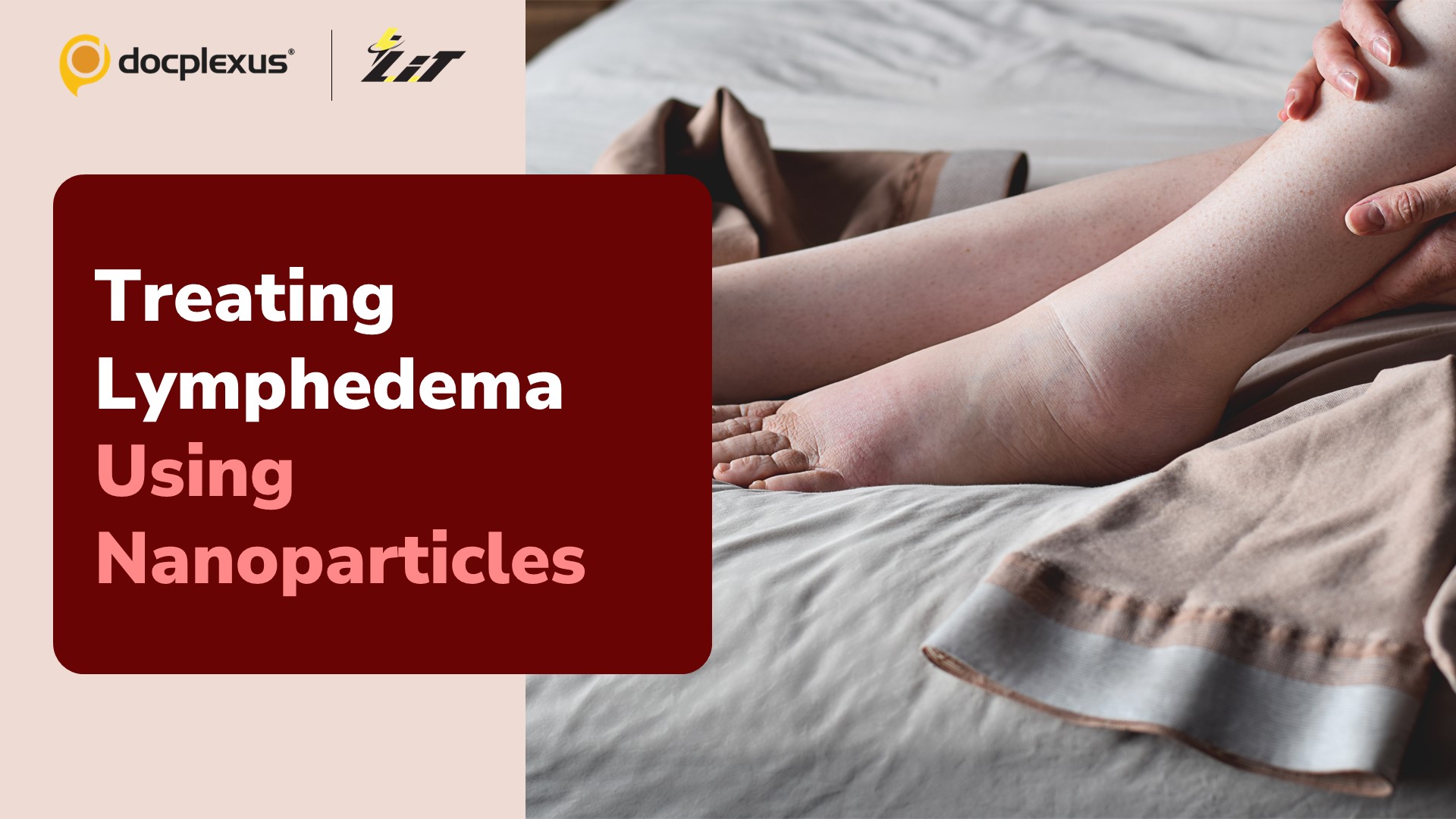 Boosting Lymphatic Function with Nanoparticles for Lymphedema