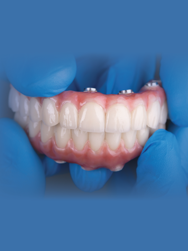 Oral Implantology: For Physicians and Surgeons