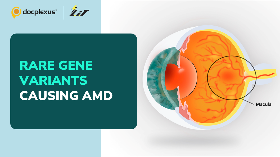 Rare Gene Variants Could Potentially Cause AMD