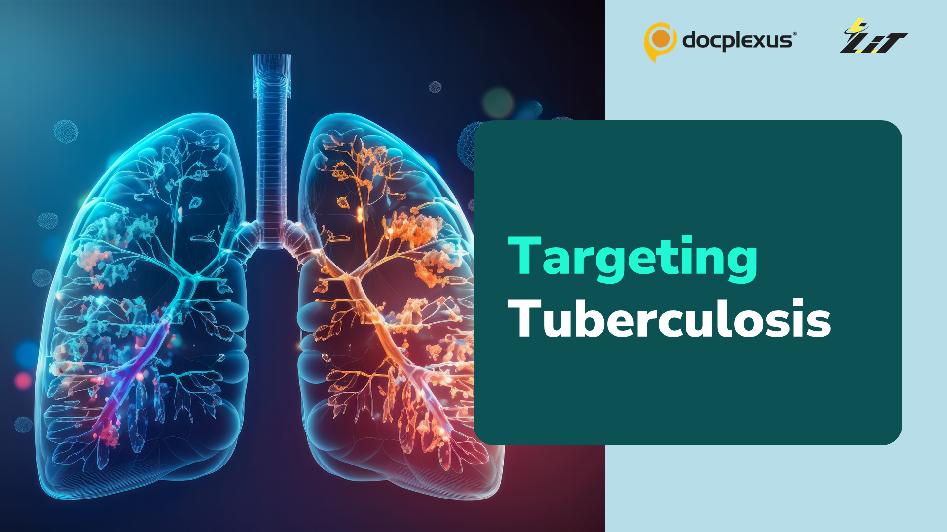 A Novel Host-directed Strategy for Tackling TB
