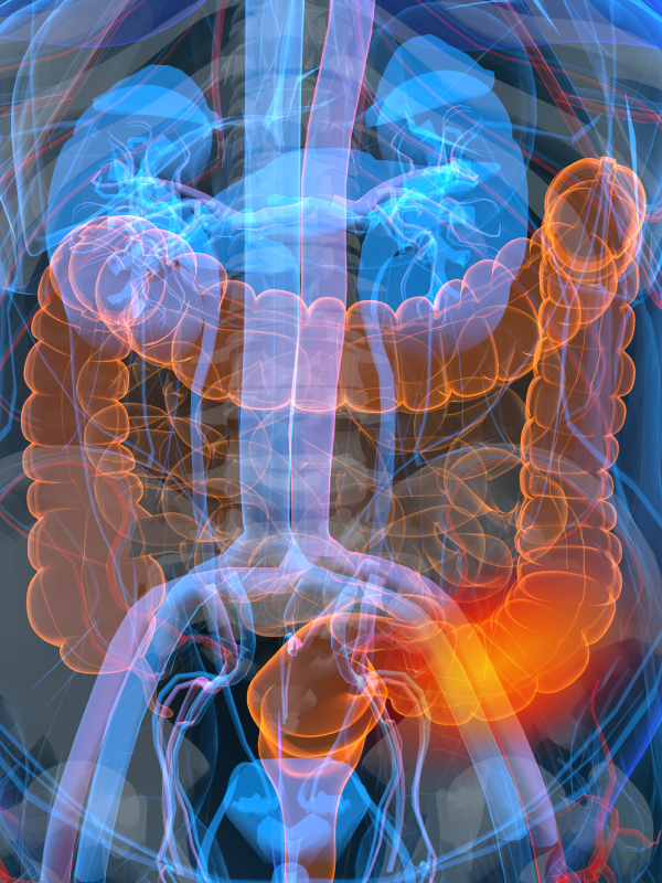 Colorectal Cancer – Surgical Management