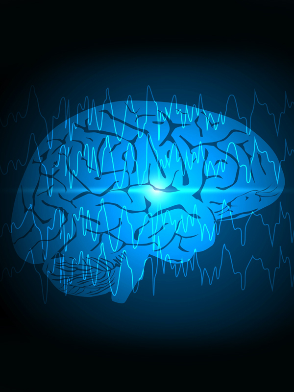 A to Z of Status Epilepticus