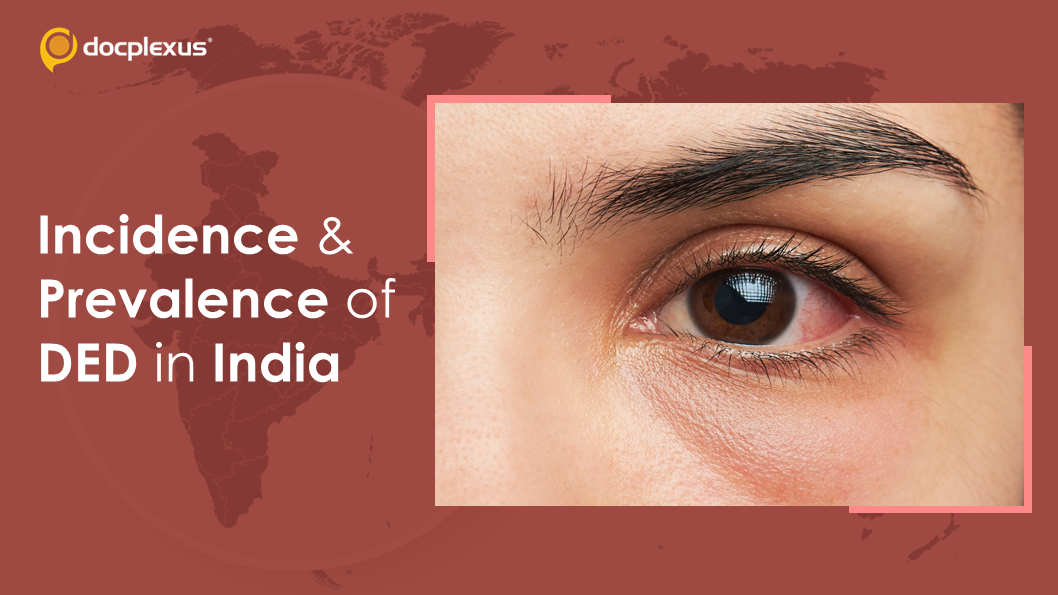 Incidence, Demographics And Risk Factors Of DED: The Indian Scenario