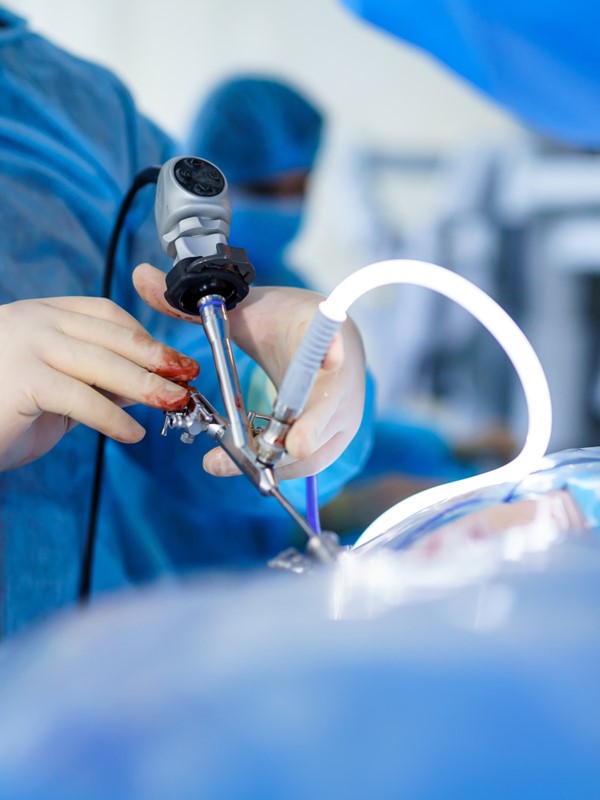 Improving Access to Laparoscopic Surgery in Low-resource Settings