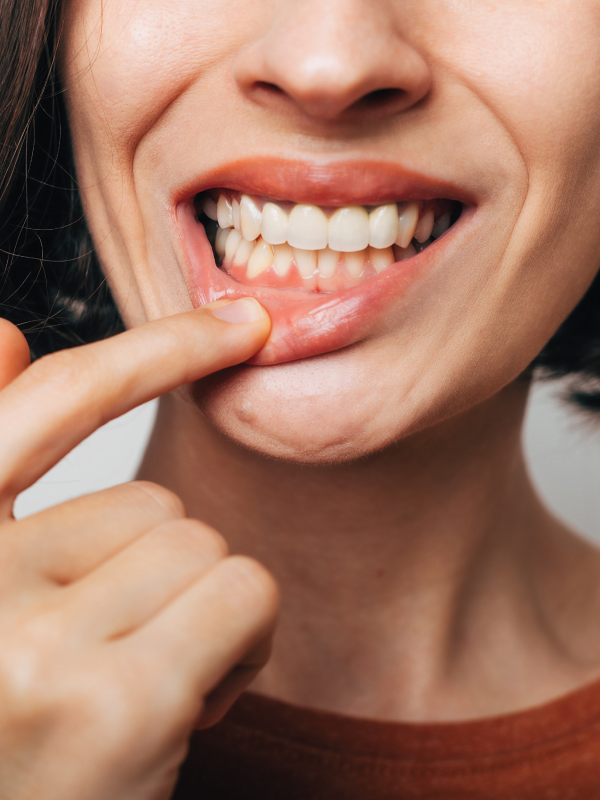 Periodontal Disease: A Genetic Perspective