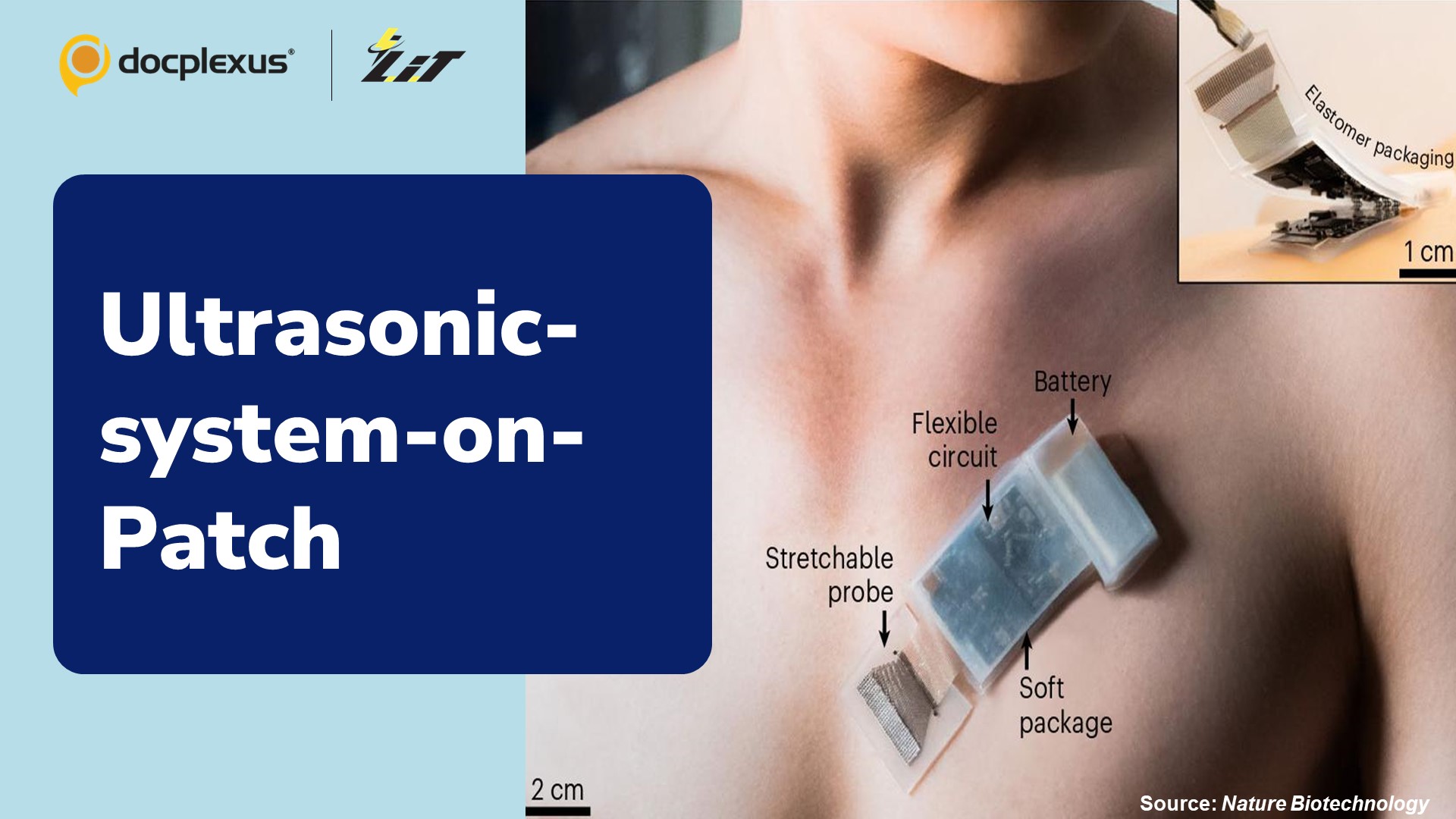 Wearable Ultrasound Device – A Breakthrough in Internet of Medical Things!