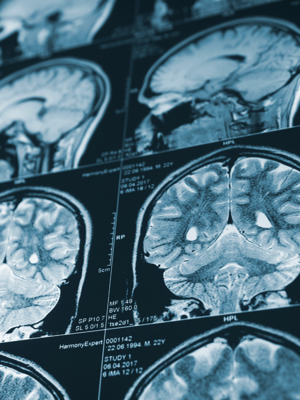 Emergency Imaging
