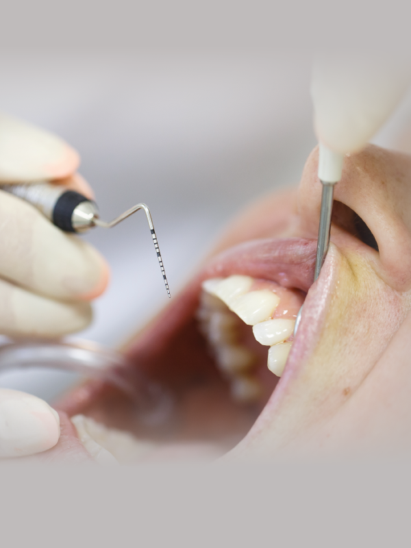 Host Modulation Therapy in Periodontics