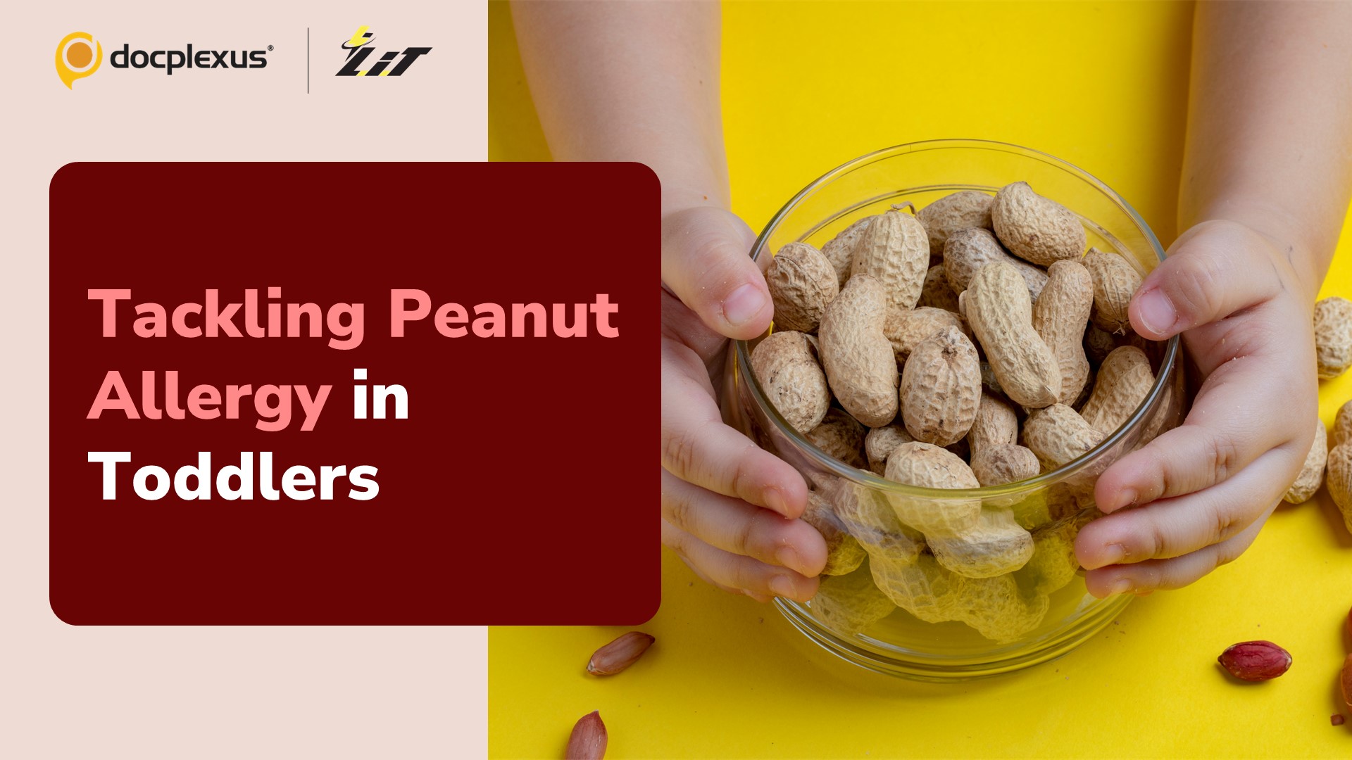 Epicutaneous Immunotherapy for Toddlers with Peanut Allergy