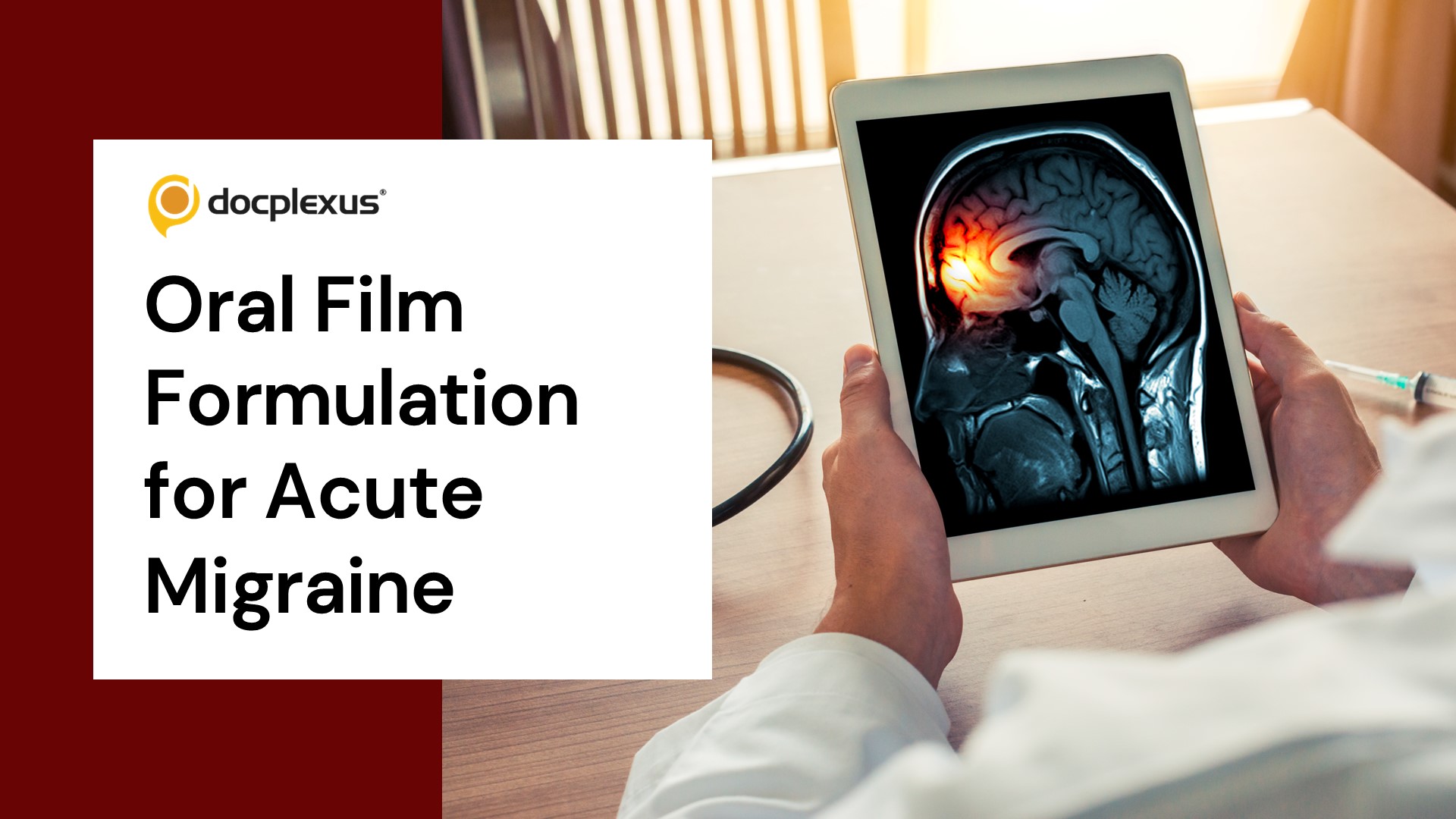 FDA Approves Rizatriptan Oral Film for Migraine