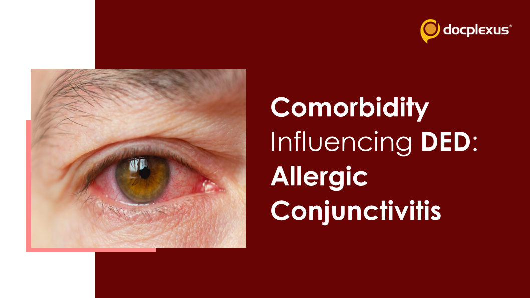 DED & Allergic Conjunctivitis: Two Different Yet Overlapping Conditions