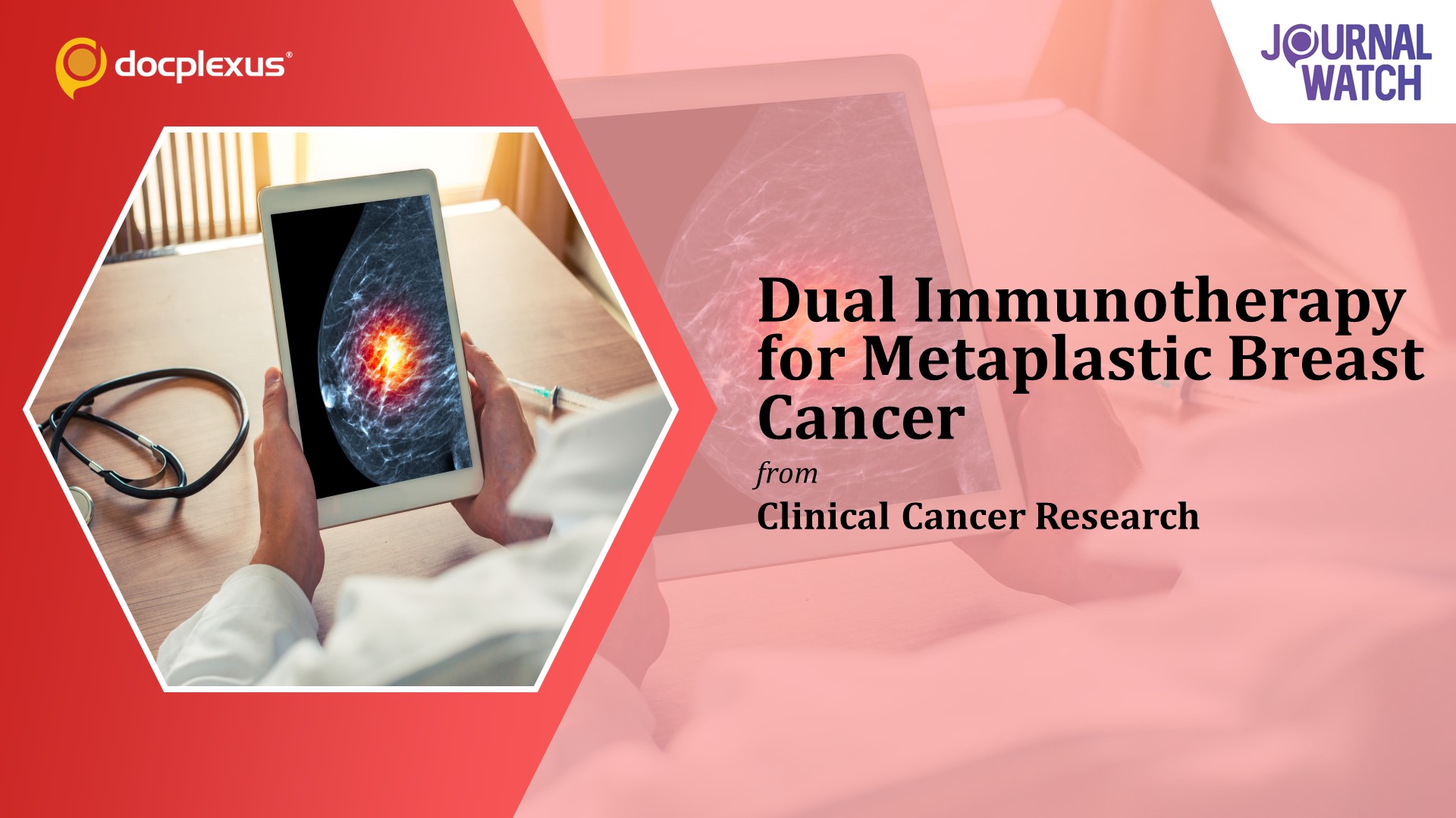 Combination of Ipilimumab and Nivolumab for Metaplastic Breast Cancer