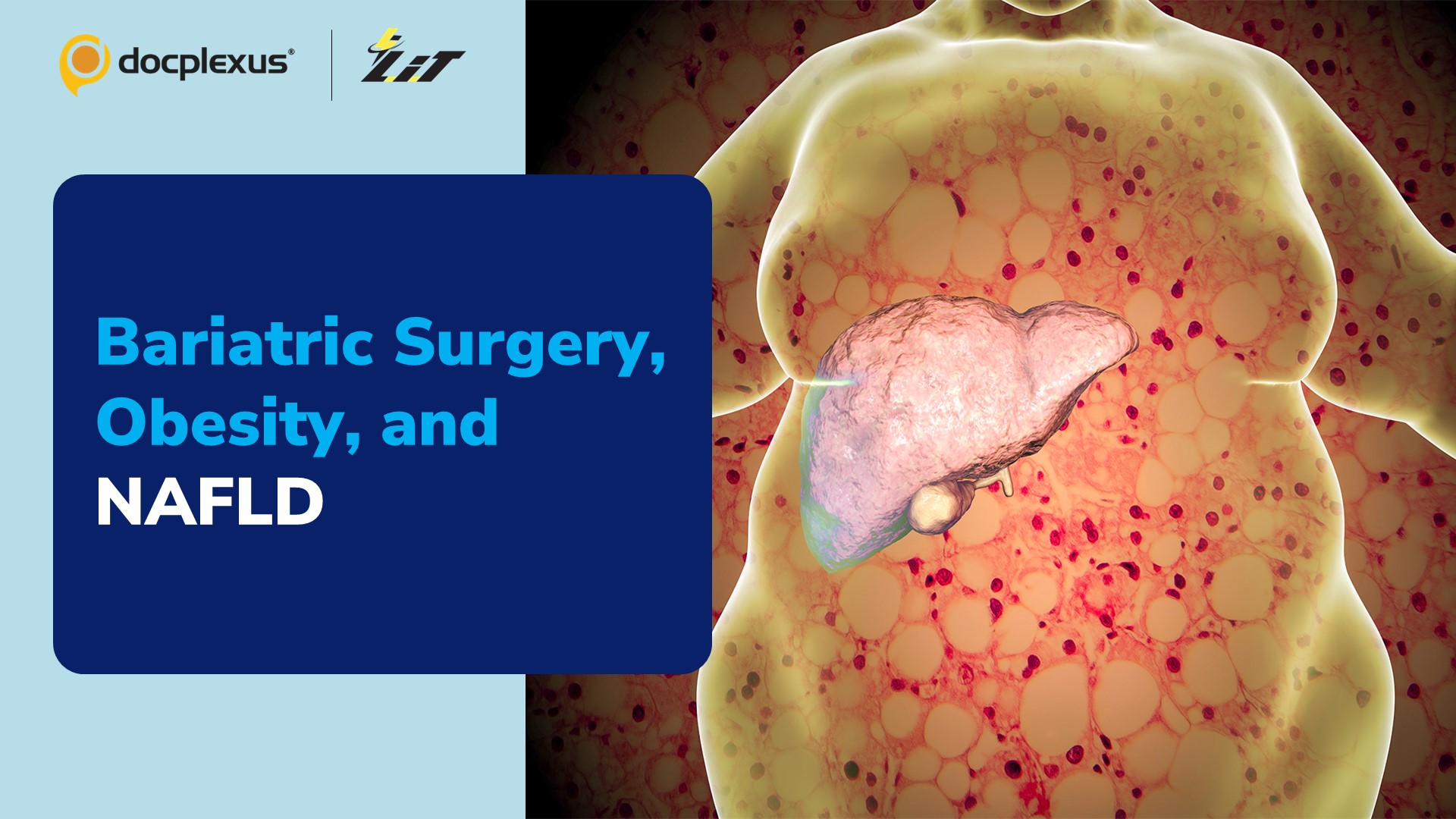 Bariatric Surgery May Cut CVD Risk in Patients with NAFLD & Obesity