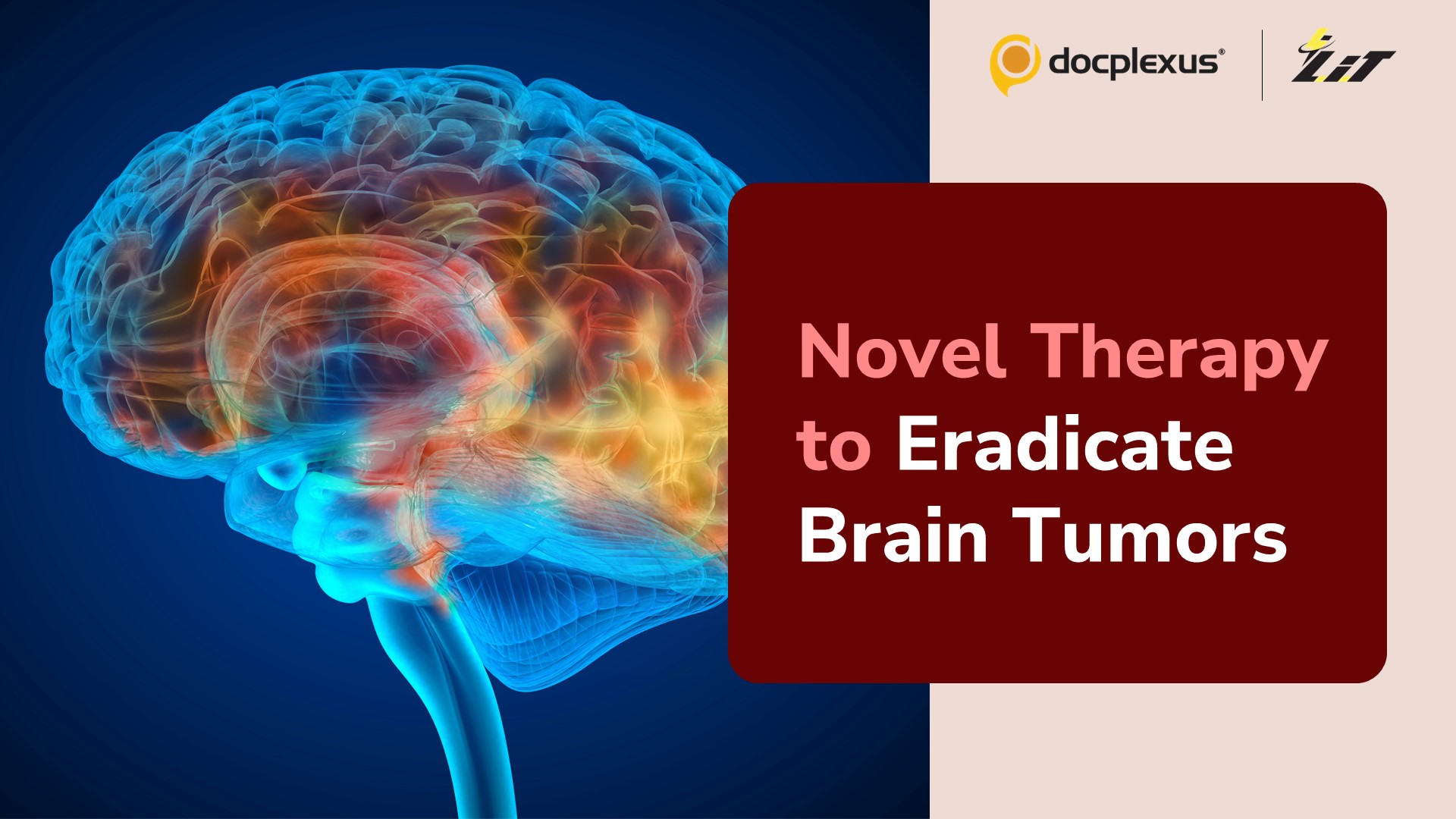 LIGHT Therapy Helps Immune System Promote Anti-tumor Immunity in Glioma
