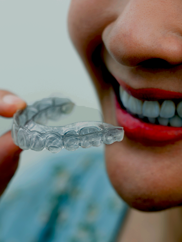 Clear Aligners: The Future is Here