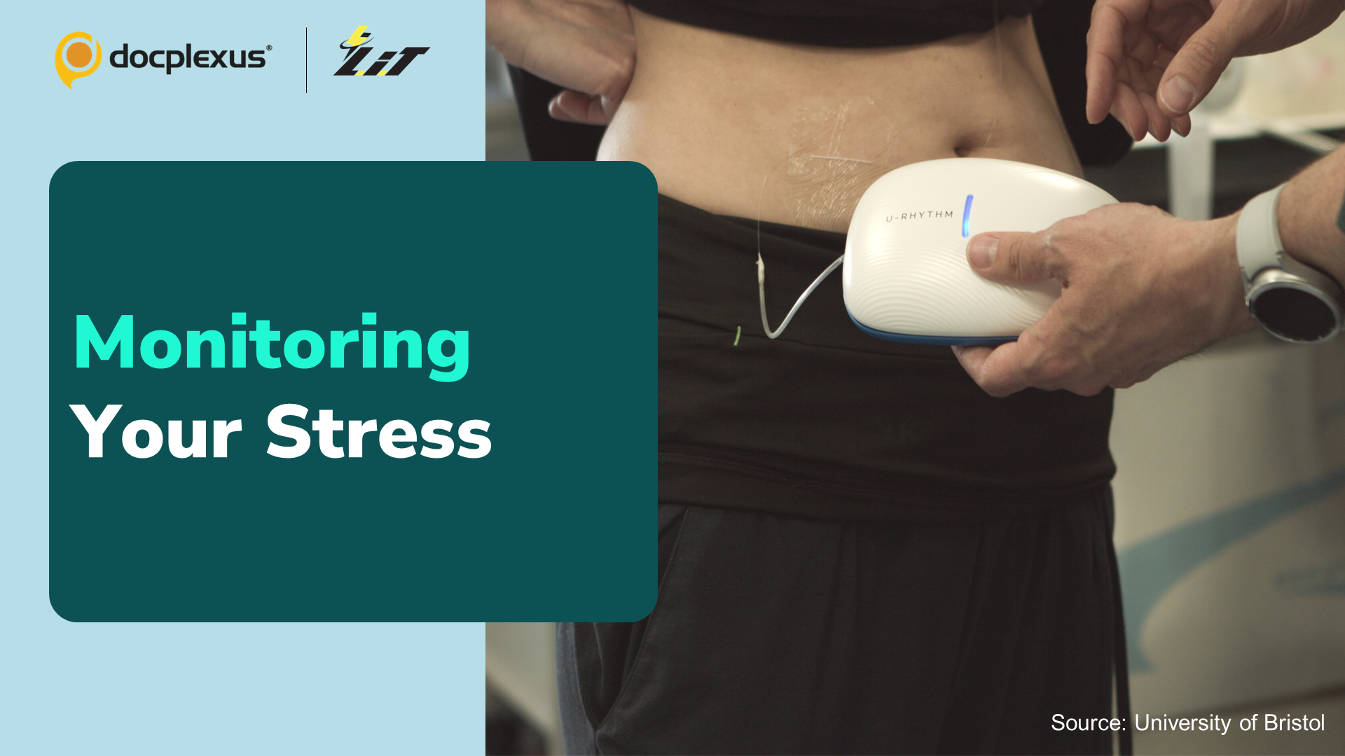 A Wearable Device to Monitor Stress Levels