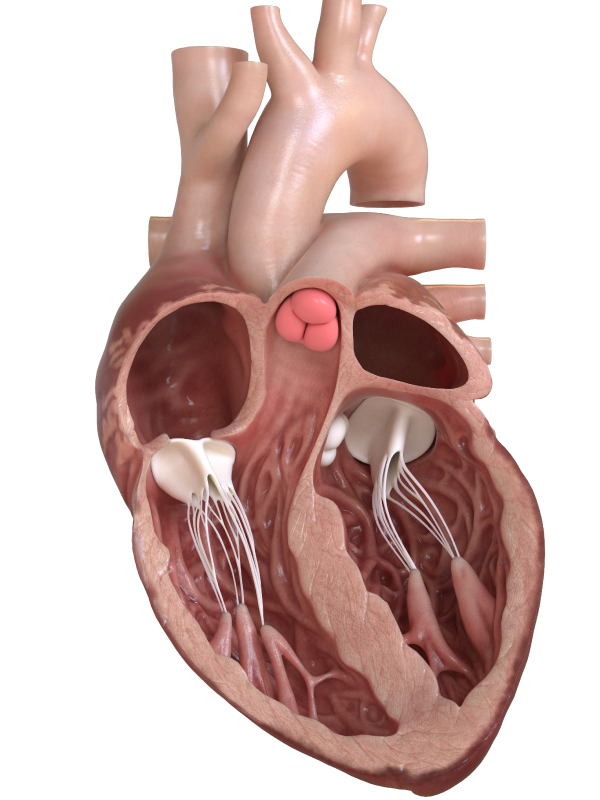 Valvular Heart Disease