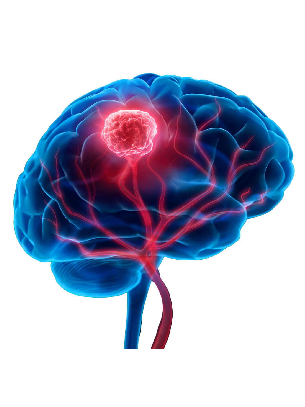 Treatable Neurometabolic Disorders in Children