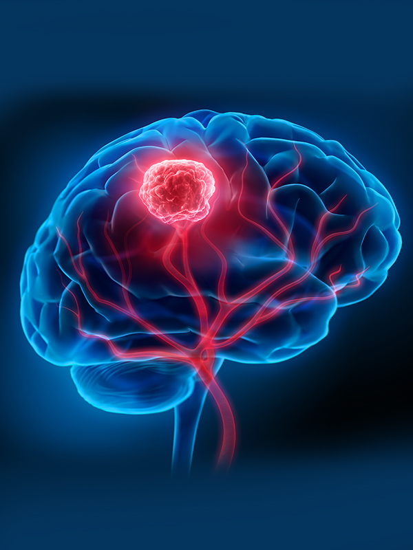 Treatable Neurometabolic Disorder in Children