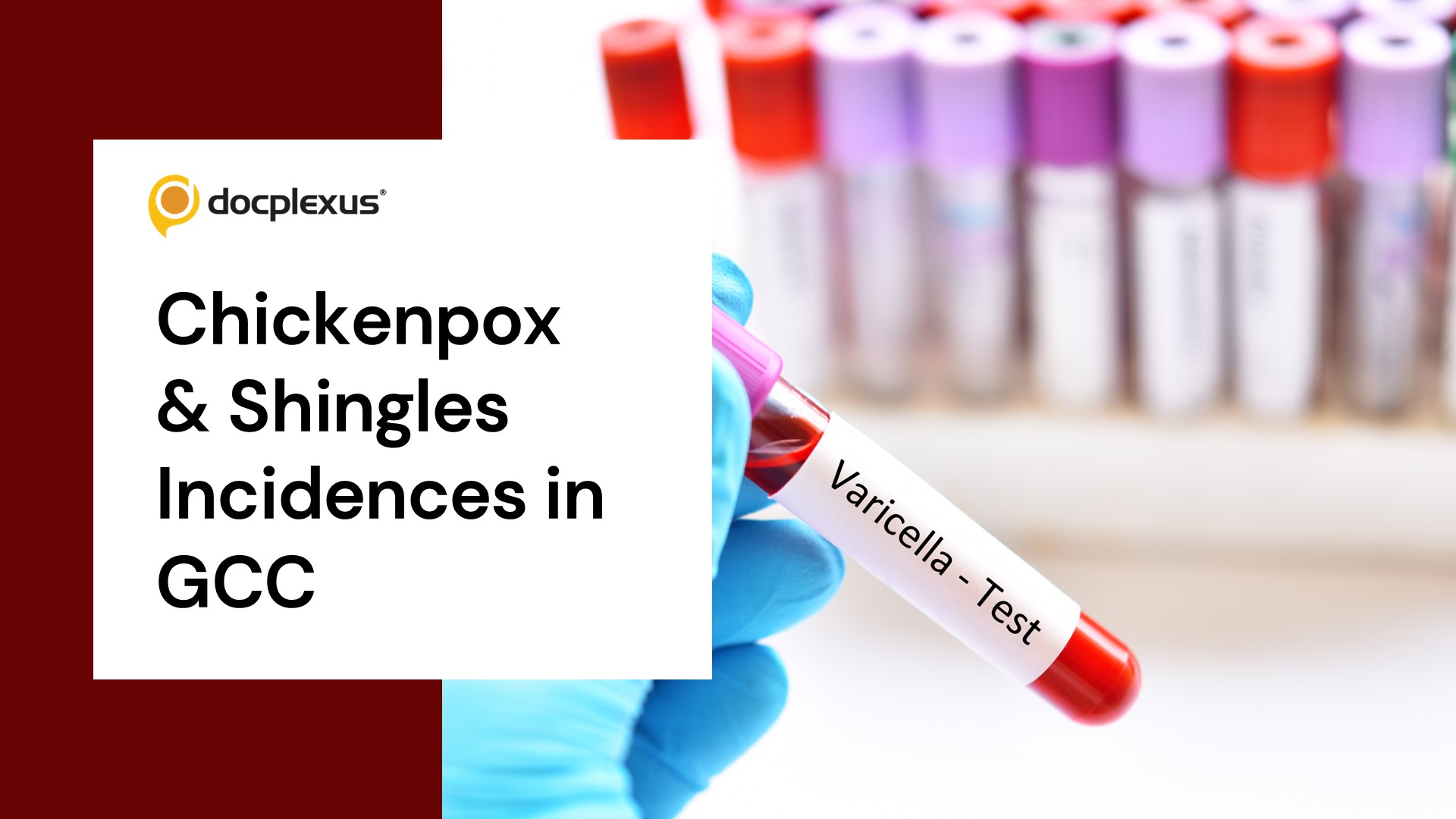 Gaps in Evidence of Chickenpox and Shingles Incidences in GCC Countries