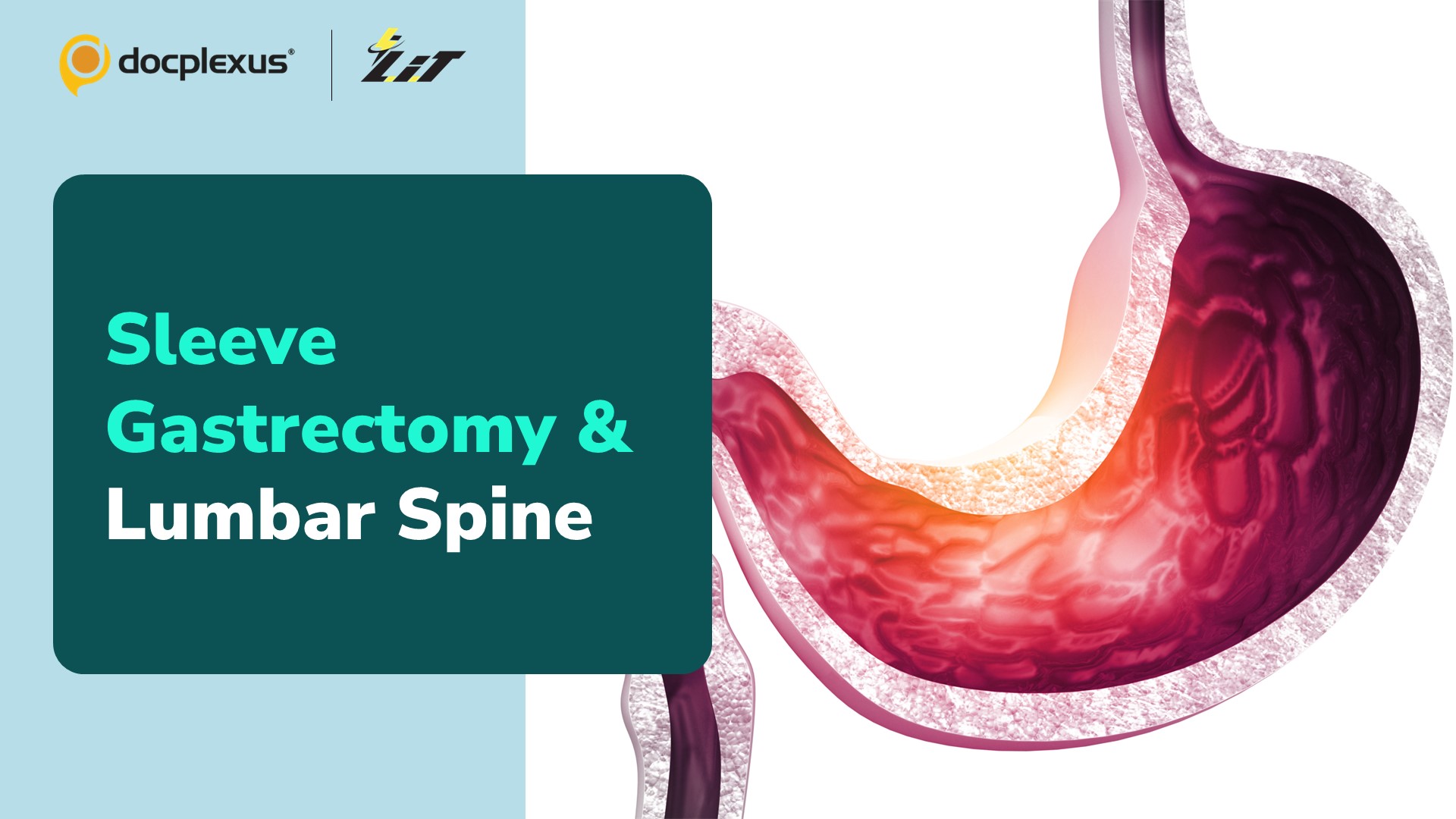 Does Sleeve Gastrectomy Affect Vertebral Bone Health of Pediatric Patients?
