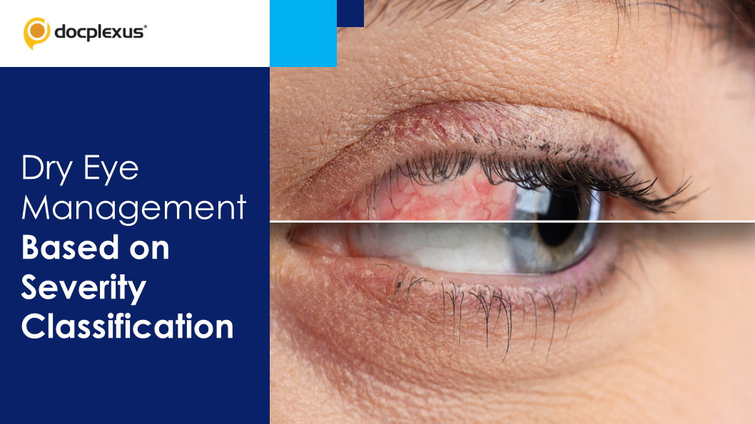 DED Severity Classification: A Systematic Approach to Treat DED