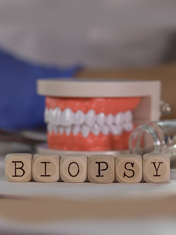 Oral Biopsy in Dental Practice