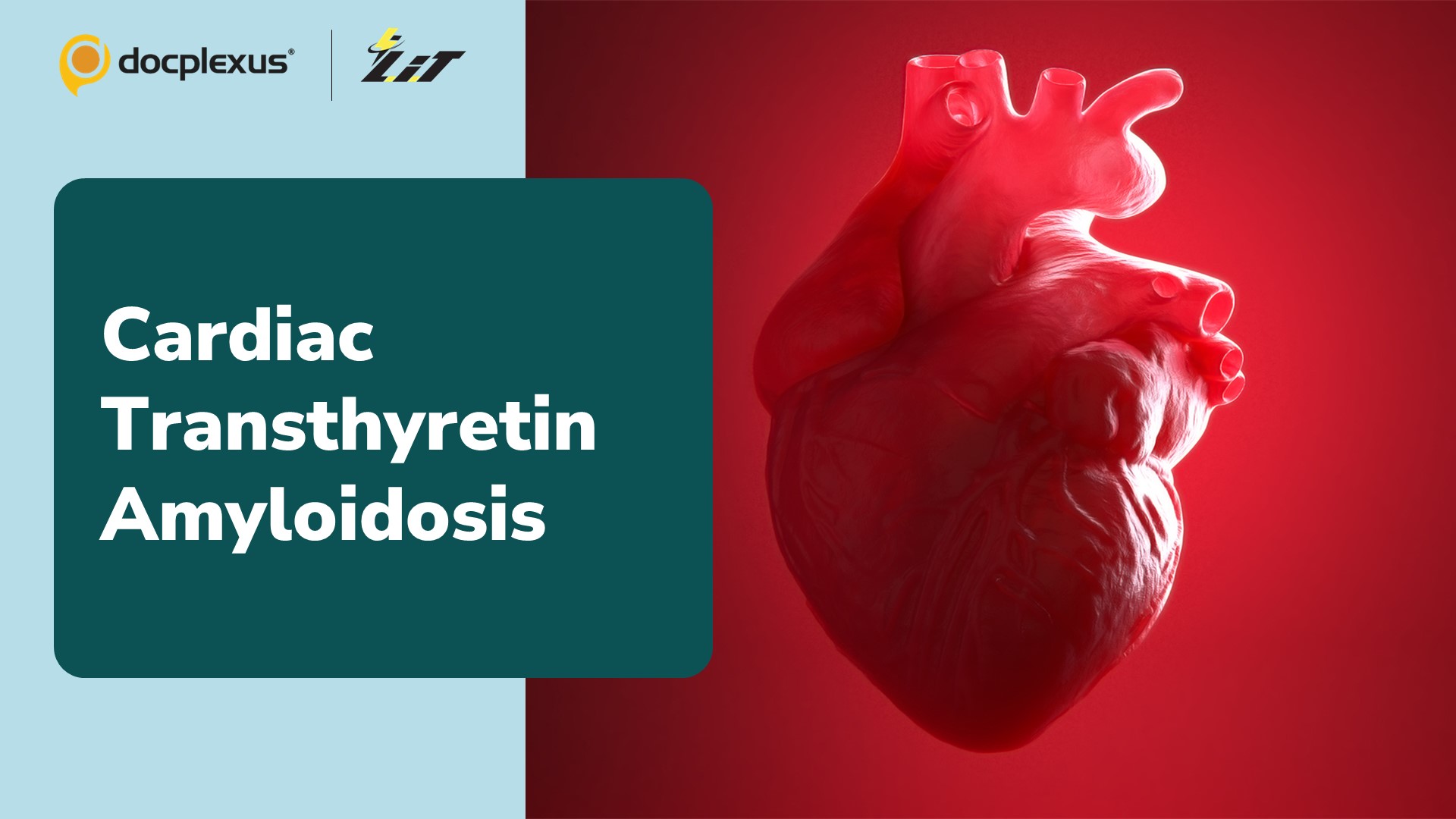 Can Cardiac Transthyretin Amyloidosis be Reversed?