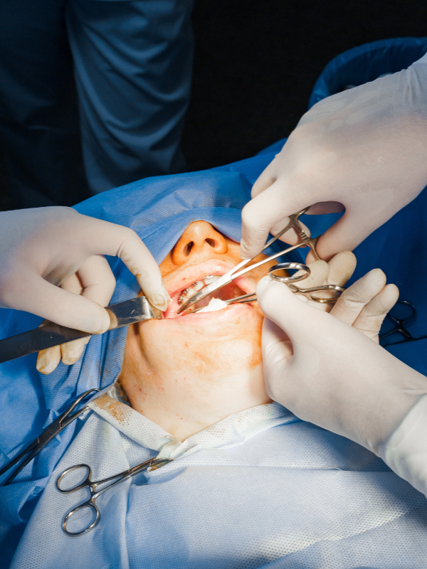 Compartment Resection of Advanced Buccal Cancer