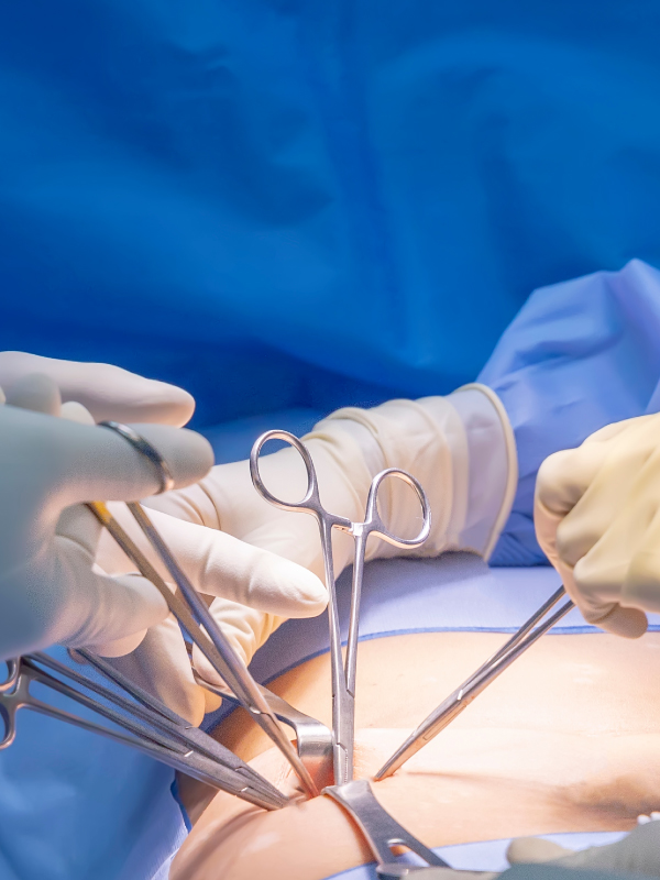 Safe Laparoscopic Cholecystectomy