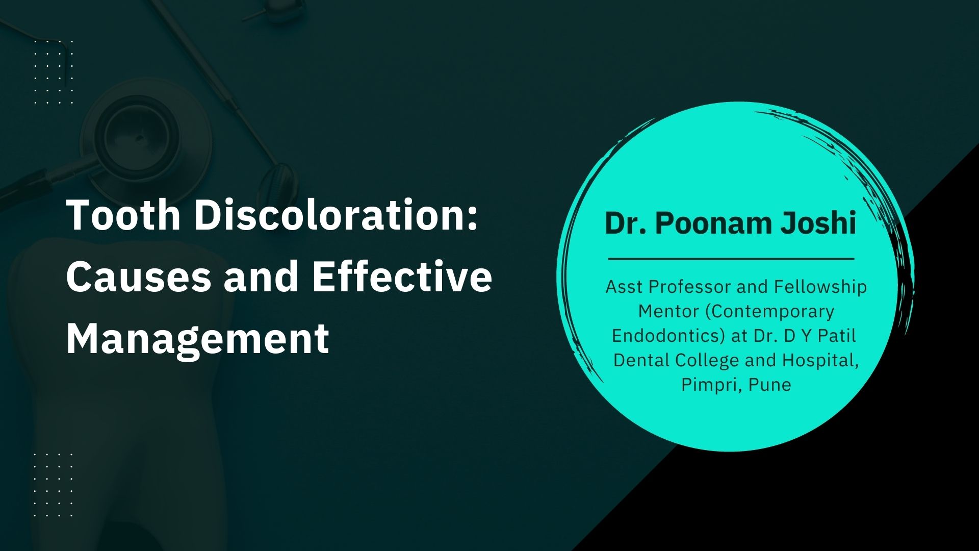 Tooth Discoloration: Causes and Effective Management