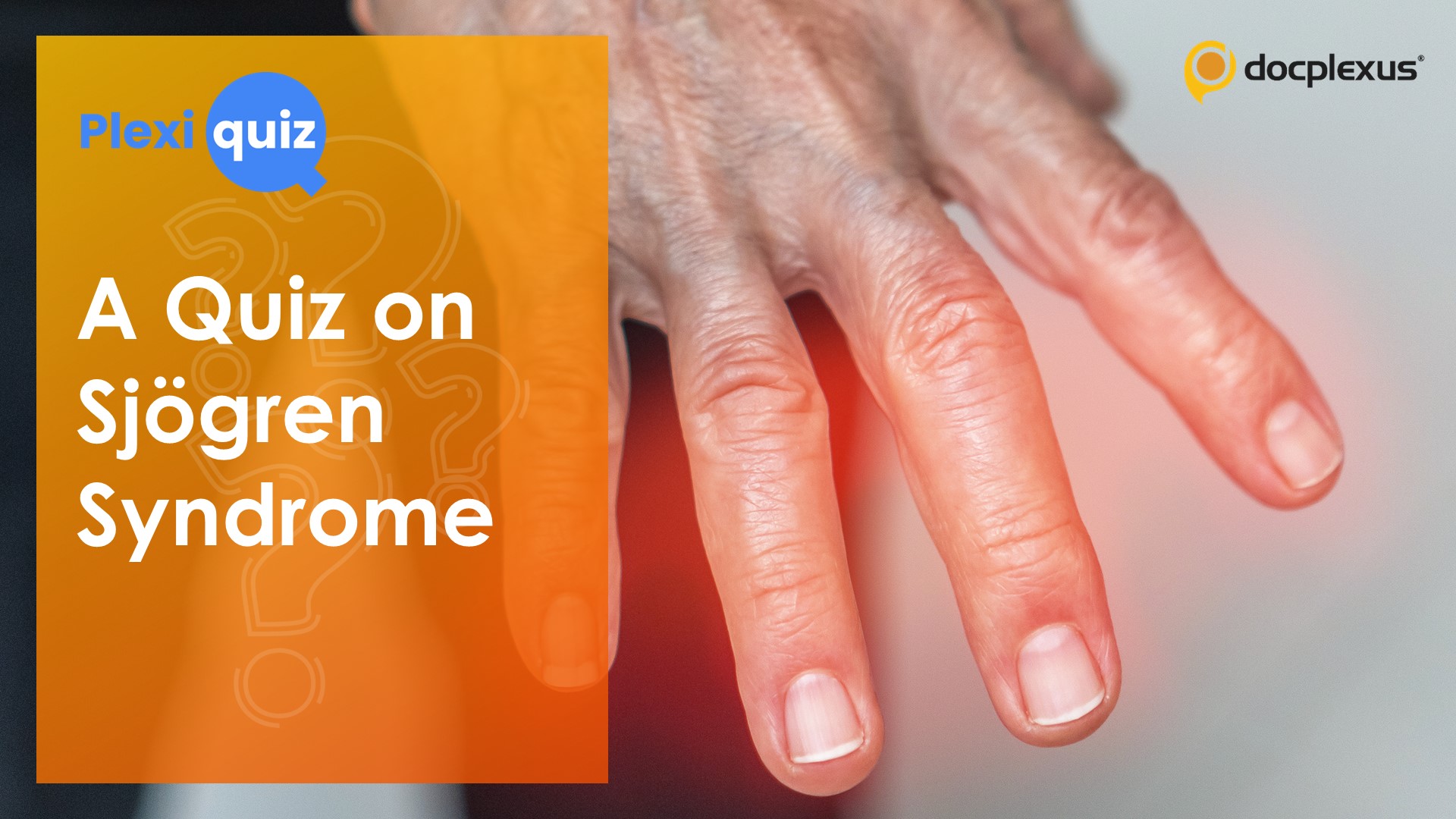 Ace This Quiz on Sjögren Syndrome