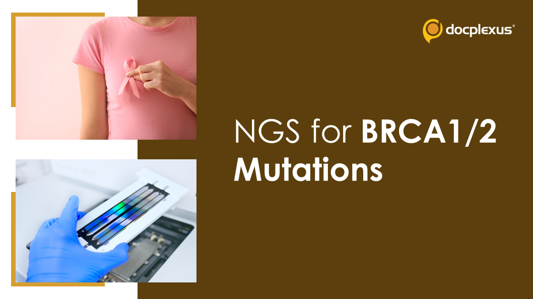 Analysis of BRCA-1 and BRCA-2 Pathogenic Variants in Breast Cancer Using NGS