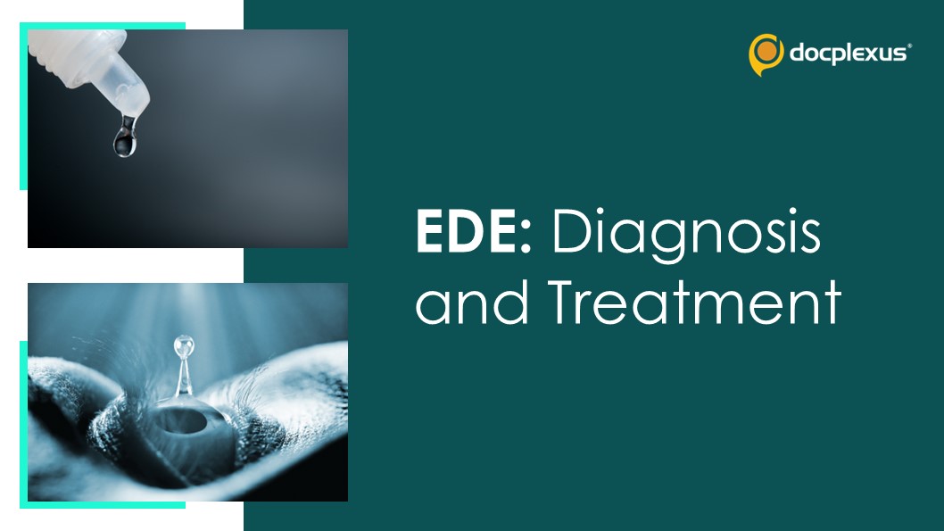 From Diagnosis to Restoration: Navigating the Complexity of Evaporative Dry Eye Management