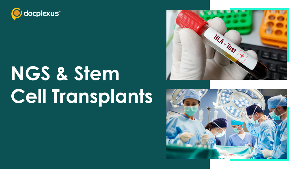 Improving Transplant Outcomes: NGS-based High-resolution HLA Typing