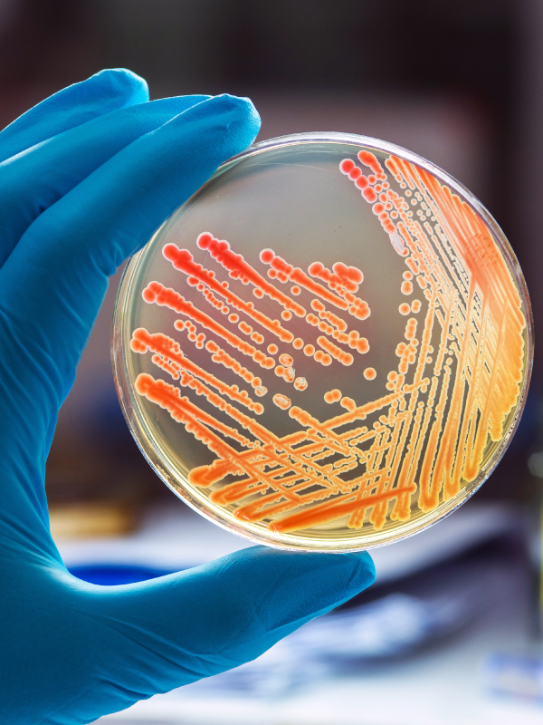 Unknowns in Microbiology Labs and Reports