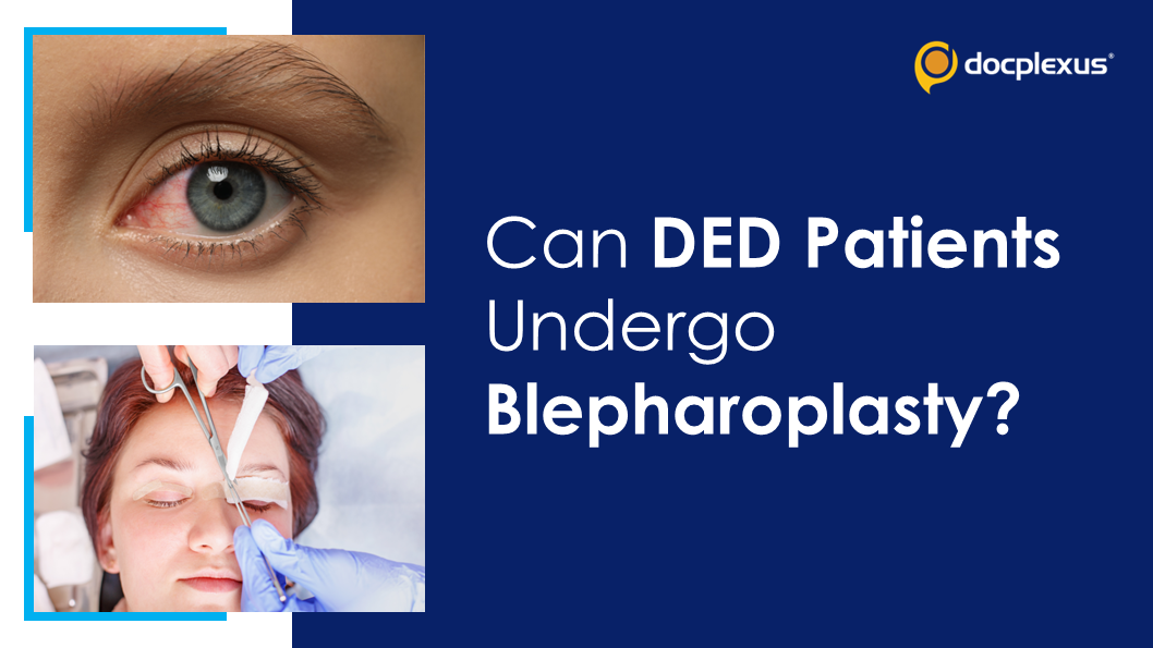 DED & Blepharoplasty: Is Preoperative Evaluation Of DED Required?