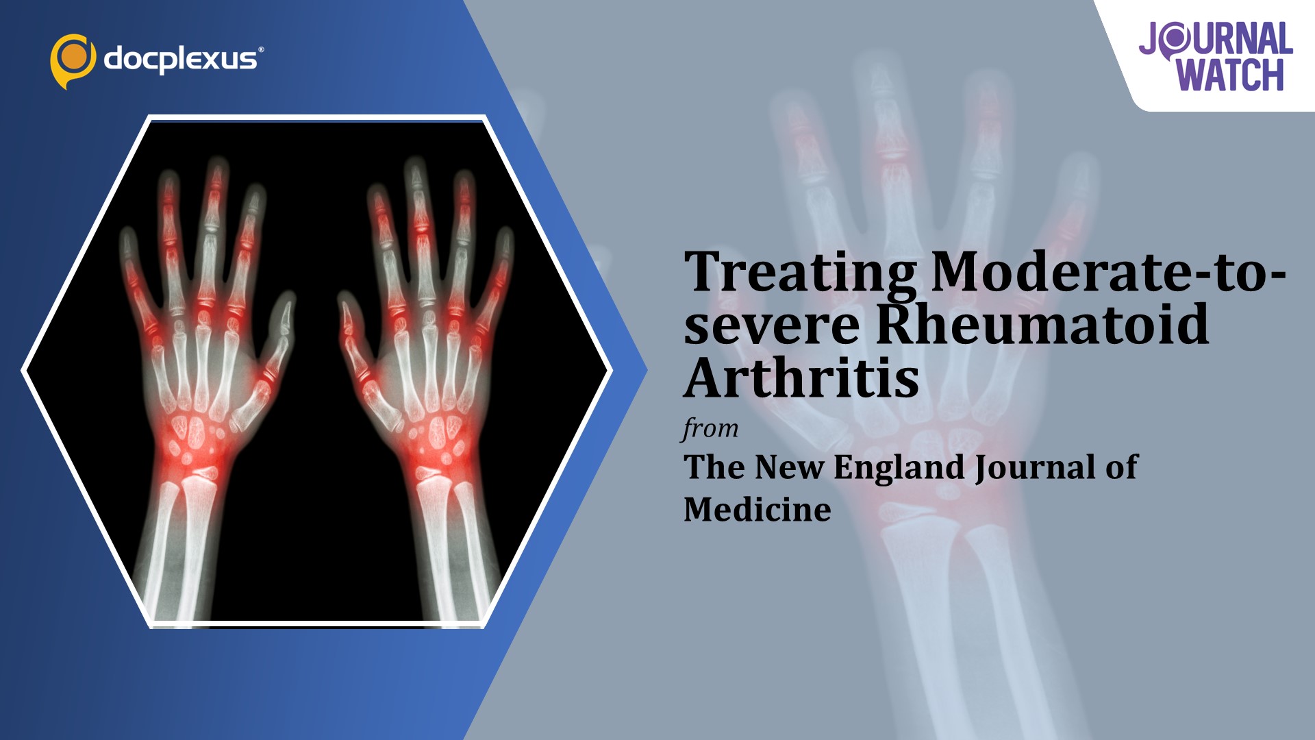 Efficacy and Safety of Peresolimab for Rheumatoid Arthritis