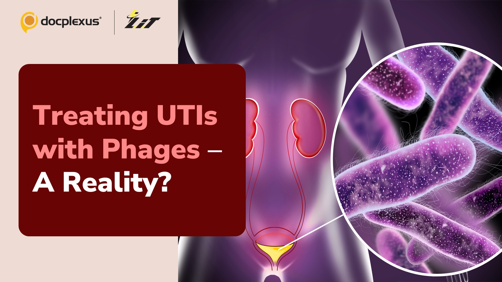 Bacteriophage Therapeutics to Treat UTIs