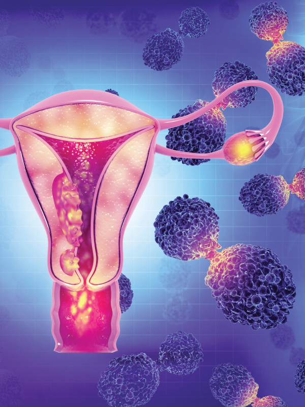 Systemic Therapy in Endometrial Cancers