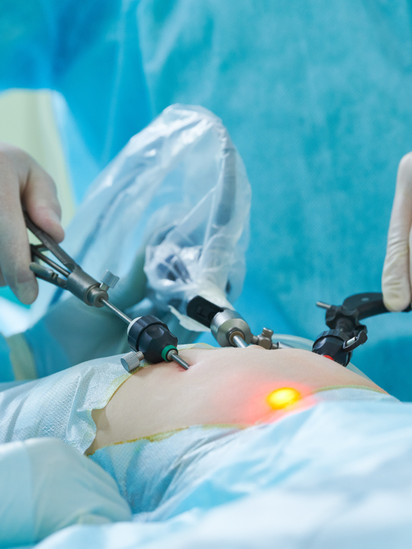 Safe Laparoscopic Cholecystectomy