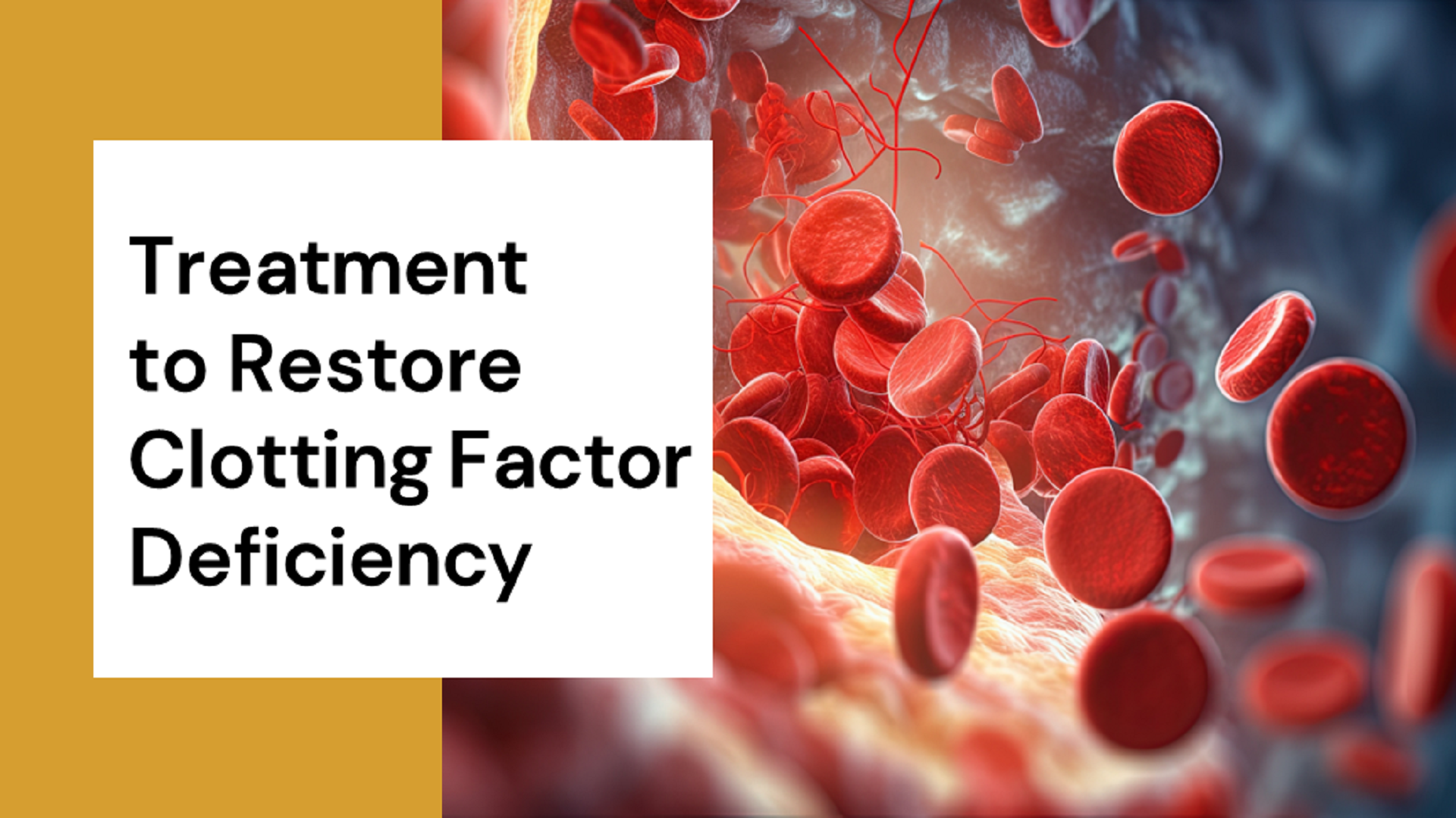 USFDA Approves Treatment for Clotting Factor Deficiency Due to Warfarin