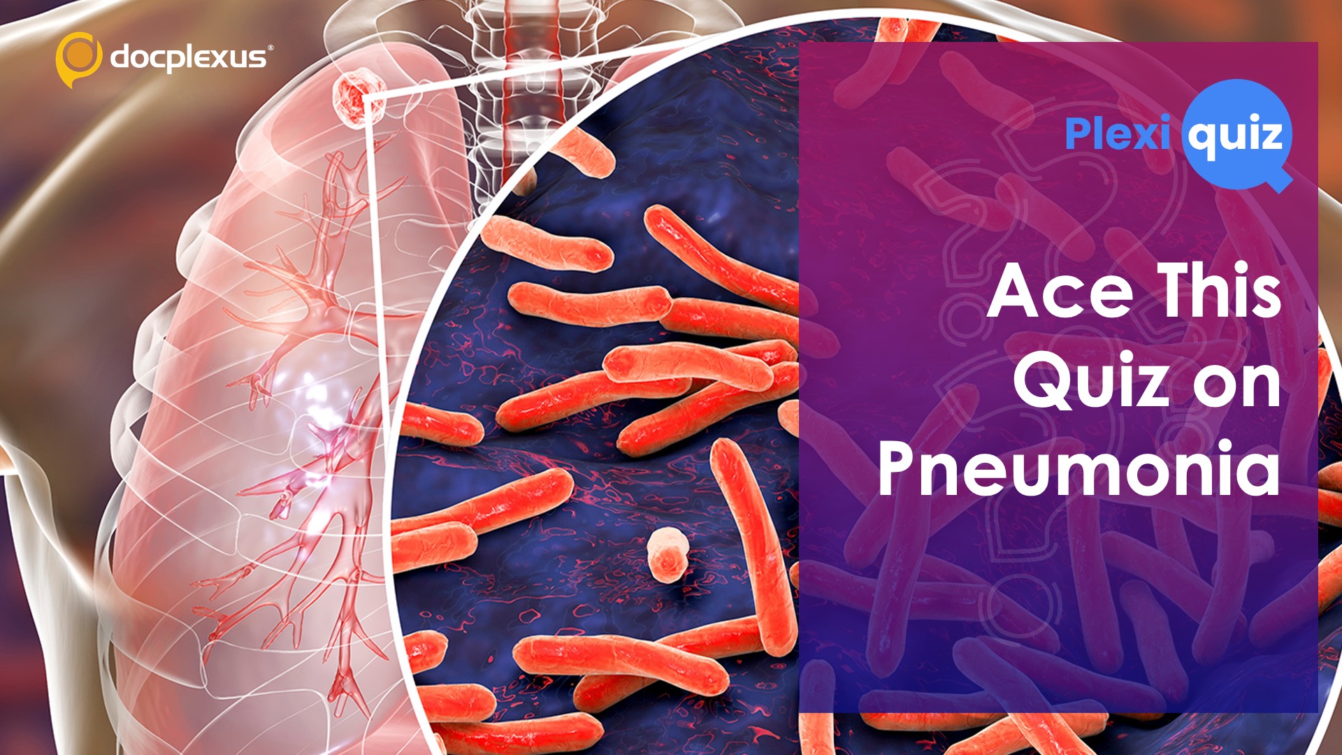 Ace This Quiz on Pneumonia!