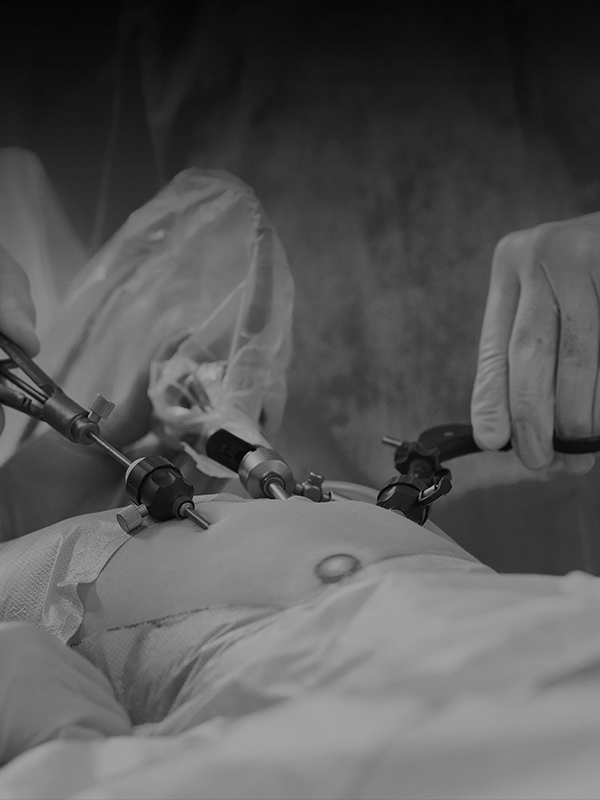 Safe Laparoscopic Cholecystectomy