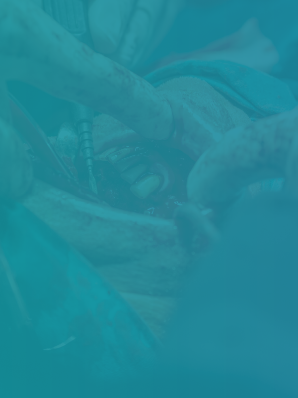 Reconstruction of Oral Cavity Cancer