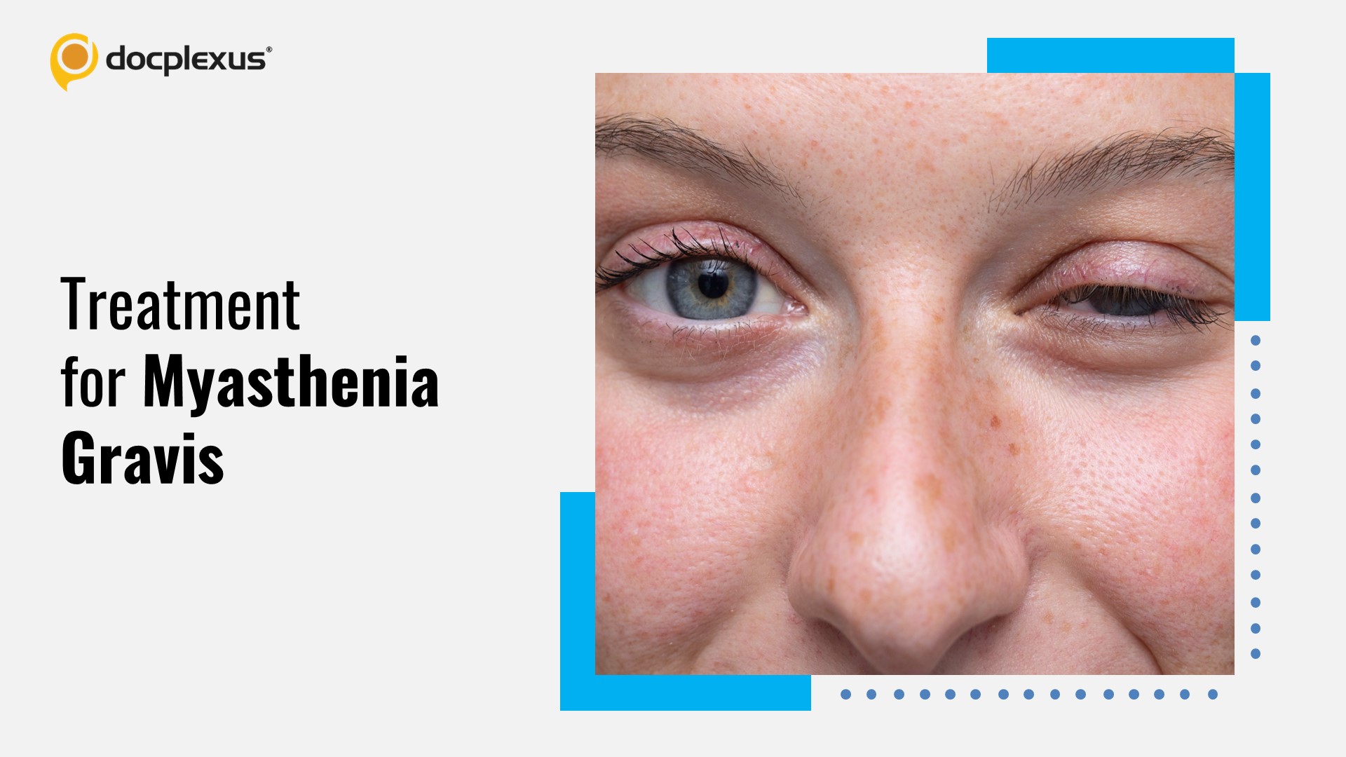 FDA Approves Rozanolixizumab for Myasthenia Gravis