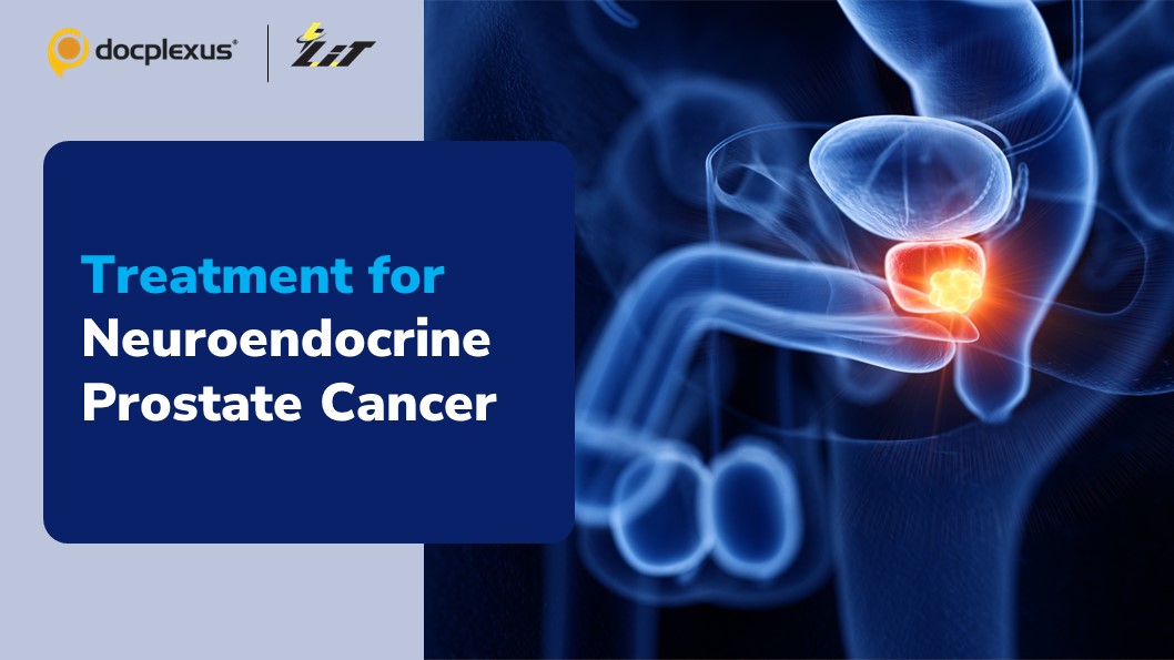 New Therapeutic Target for a Rare and Aggressive Form of Prostate Cancer