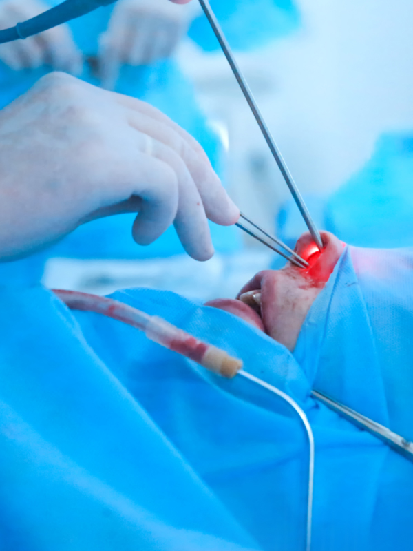 Endoscopic Facial Rejuvenation – The Next Level