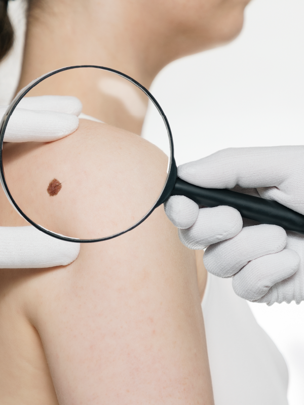 Managing the Spectrum of Advanced Skin Malignancy