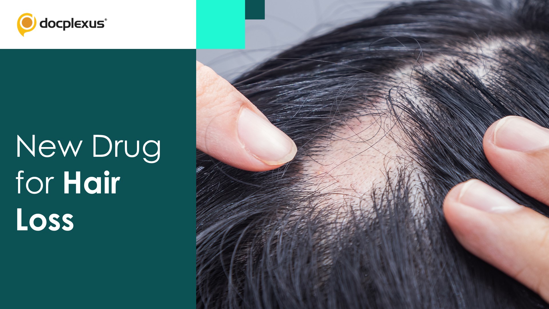 USFDA Approves Ritlecitinib for Alopecia Areata